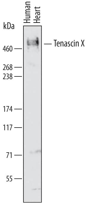 Detection of Human Tenascin X antibody by Western Blot.