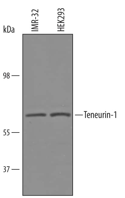 Detection of Human Teneurin-1 antibody by Western Blot.