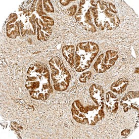 Tensin 4/CTEN antibody in Human Prostate by Immunohistochemistry (IHC-P).