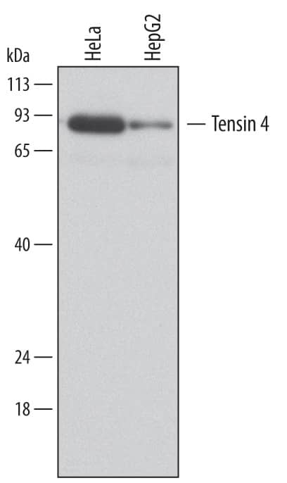 Detection of Human Tensin 4/CTEN antibody by Western Blot.