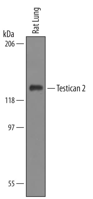 Detection of Rat Testican 2/SPOCK2 antibody by Western Blot.