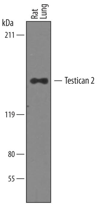 Detection of Rat Testican 2/SPOCK2 antibody by Western Blot.