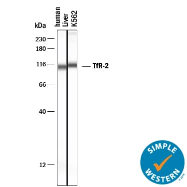 Detection of Human TfR2 antibody by Simple WesternTM.
