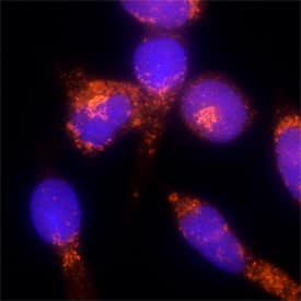TGN38 antibody in RBL-2H3 Rat Cell Line by Immunocytochemistry (ICC).