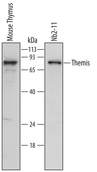 Detection of Mouse and Rat Themis antibody by Western Blot.