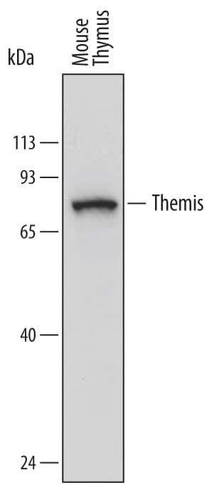 Detection of Mouse Themis antibody by Western Blot.