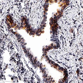 Thioredoxin-1 antibody in Human Lung by Immunohistochemistry (IHC-P).