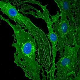 Thrombomodulin/BDCA-3 antibody in bEnd by Immunocytochemistry (ICC).3 Mouse Cell Line by Immunocytochemistry (ICC).