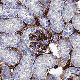 Thrombomodulin/BDCA-3 antibody in Human Kidney Tissue by Immunohistochemistry (IHC-P).