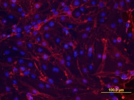 Thrombomodulin/BDCA-3 antibody in bEnd by Immunocytochemistry (ICC).3 Mouse Cell Line by Immunocytochemistry (ICC).