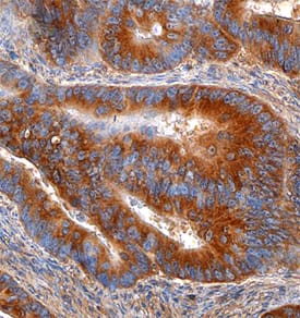 Thrombospondin-1 antibody in Human Colon by Immunohistochemistry (IHC-P).