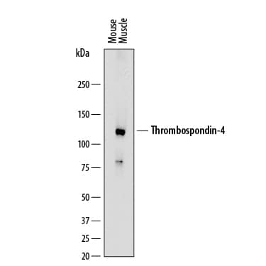 Detection of Mouse Thrombospondin-4 antibody by Western Blot.