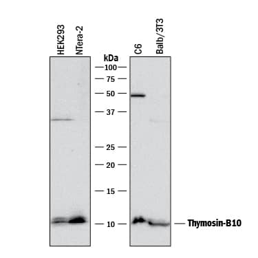 Detection of Human, Mouse, and Rat Thymosin  beta10 antibody by Western Blot.