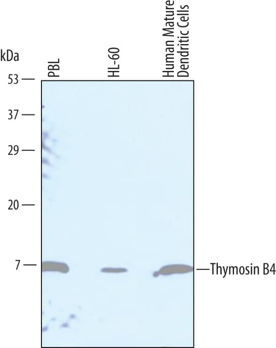 Detection of Human Thymosin  beta4 antibody by Western Blot.