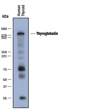 Detection of Human Thyroglobulin antibody by Western Blot.