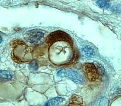 Tie-1 antibody in Human Placenta by Immunohistochemistry (IHC-P).