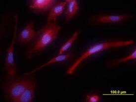 Tie-1 antibody in HUVEC Human Cells by Immunocytochemistry (ICC).