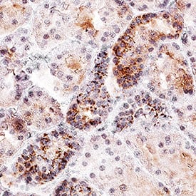 Phospho-Tie-2 (Y992) antibody in Human Kidney Tissue by Immunohistochemistry (IHC-P).