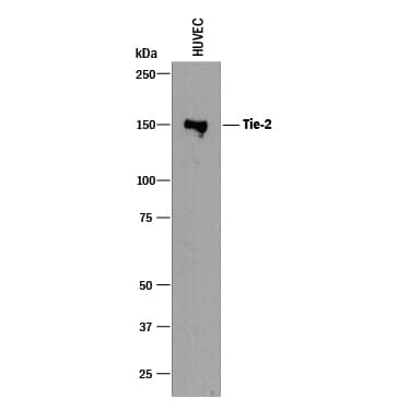 Detection of Human Tie-2 antibody by Western Blot.