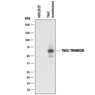 Detection of Human Tiki2/TRABD2B antibody by Western Blot.