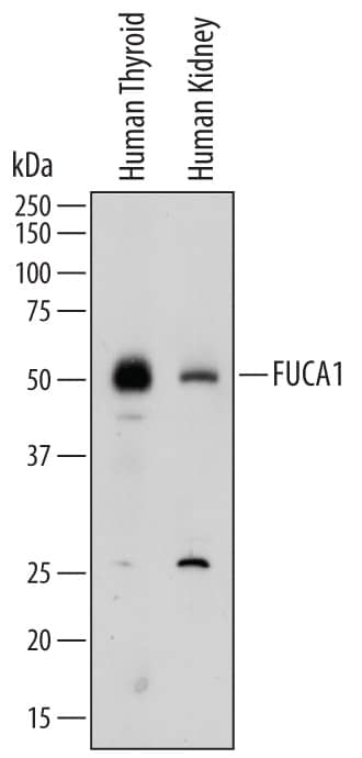 Detection of Human Tissue a-L-Fucosidase/FUCA1 antibody by Western Blot.