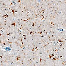 Tmp21/p23 antibody in Human Alzheimer's Brain by Immunohistochemistry (IHC-P).