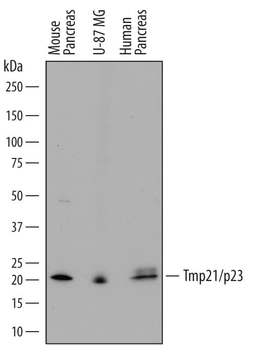 Detection of Human and Mouse Tmp21/p23 antibody by Western Blot.