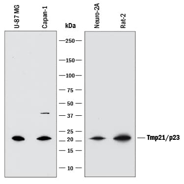 Detection of Tmp21/p23 antibody by Western Blot.