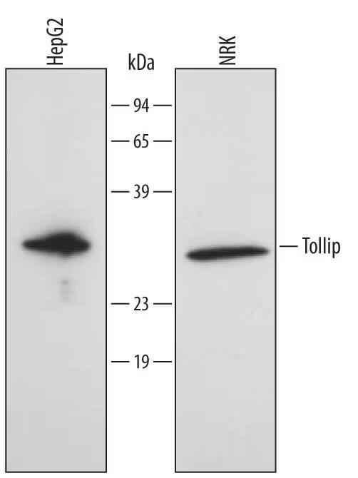 Detection of Human/Rat Tollip antibody by Western Blot.