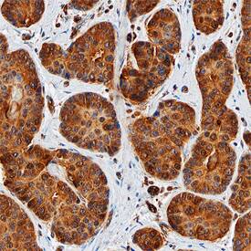 TopBP1 antibody in Human Breast by Immunohistochemistry (IHC-P).