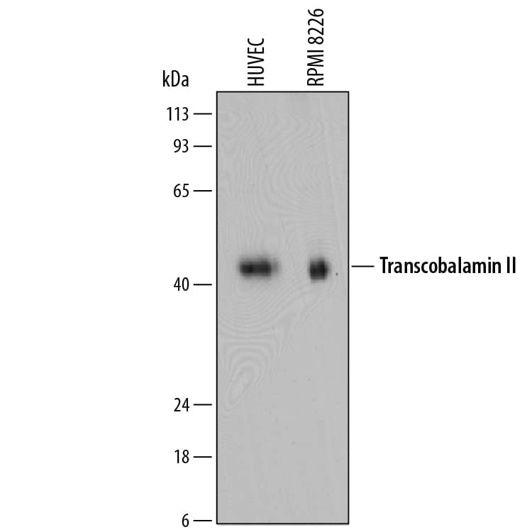 Detection of Human Transcobalamin II antibody by Western Blot.