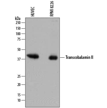 Detection of Human Transcobalamin II antibody by Western Blot.