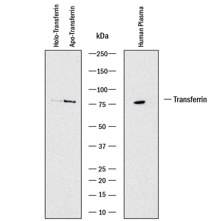 Detection of Human Transferrin antibody by Western Blot.