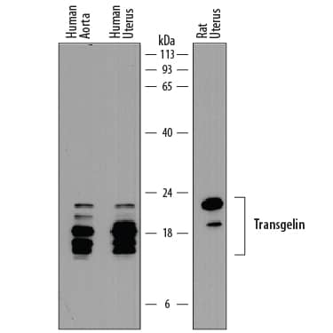 Detection of Human and Rat Transgelin/TAGLN antibody by Western Blot.