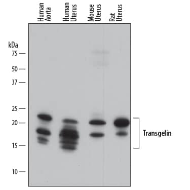 Detection of Human, Mouse, and Rat Transgelin/TAGLN antibody by Western Blot.