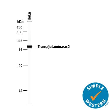Detection of Human Transglutaminase 2/TGM2 antibody by Simple WesternTM.