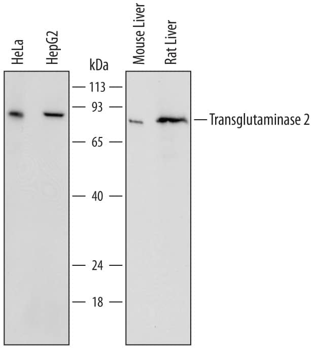 Detection of Human, Mouse, and Rat Transglutaminase 2/TGM2 antibody by Western Blot.