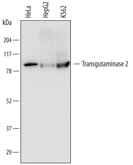 Detection of Human Transglutaminase 2/TGM2 antibody by Western Blot.