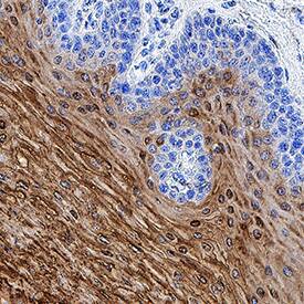 Transglutaminase 3/TGM3 antibody in Human Esophagus by Immunohistochemistry (IHC-P).