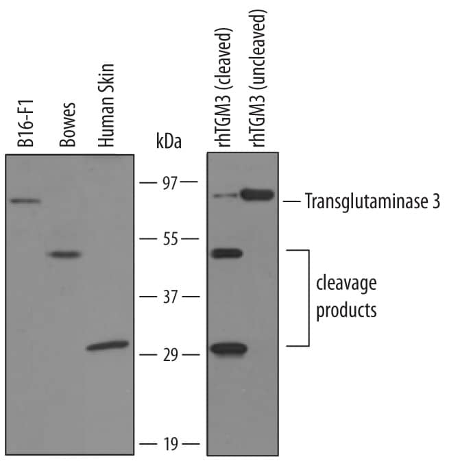 Detection of Human and Mouse Transglutaminase 3/TGM3 antibody by Western Blot.