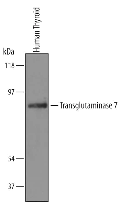 Detection of Human Transglutaminase 7/TGM7 antibody by Western Blot.