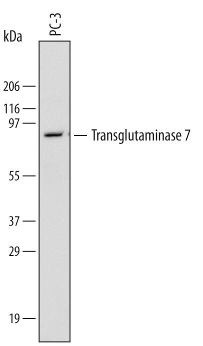 Detection of Human Transglutaminase 7/TGM7 antibody by Western Blot.