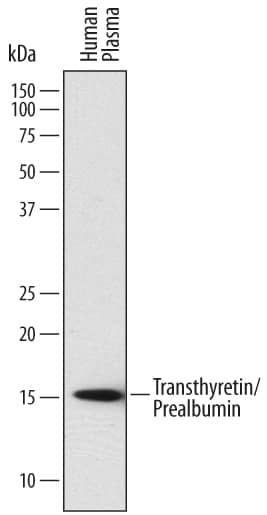 Detection of Human Transthyretin/Prealbumin antibody by Western Blot.