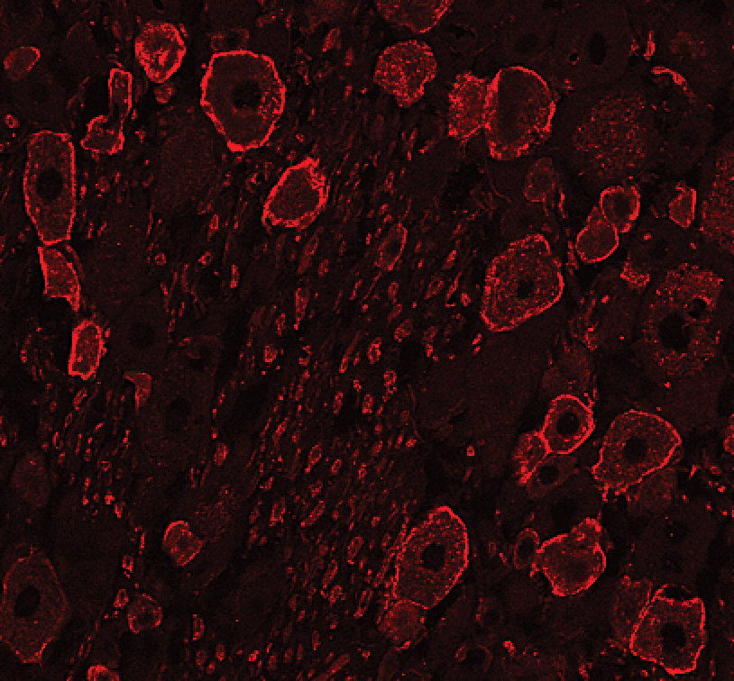 TrkA antibody in Rat Dorsal Root Ganglion by Immunohistochemistry (IHC-Fr).