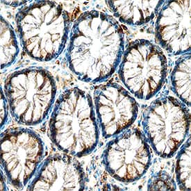 TrkA antibody in Human Colon by Immunohistochemistry (IHC-P).