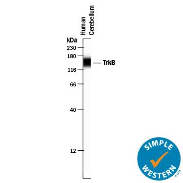 Detection of Human TrkB antibody by Simple WesternTM.