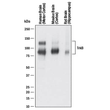Detection of Human, Mouse, and Rat TrkB antibody by Western Blot.