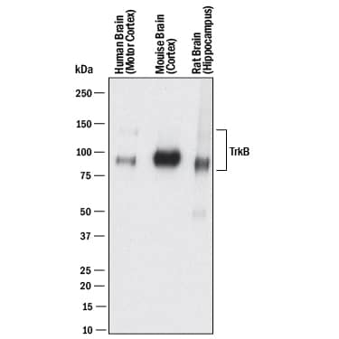 Detection of Human, Mouse, and Rat TrkB antibody by Western Blot.