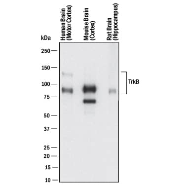 Detection of Human, Mouse, and Rat TrkB antibody by Western Blot.