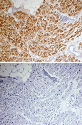 Troponin I antibody in Human Heart by Immunohistochemistry (IHC-P).